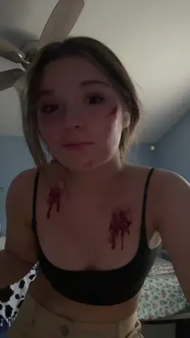 Ignore this guys (Fake wounds obvi)#fyp #relatable #funnyaudio #sexy #sfxmakeup 