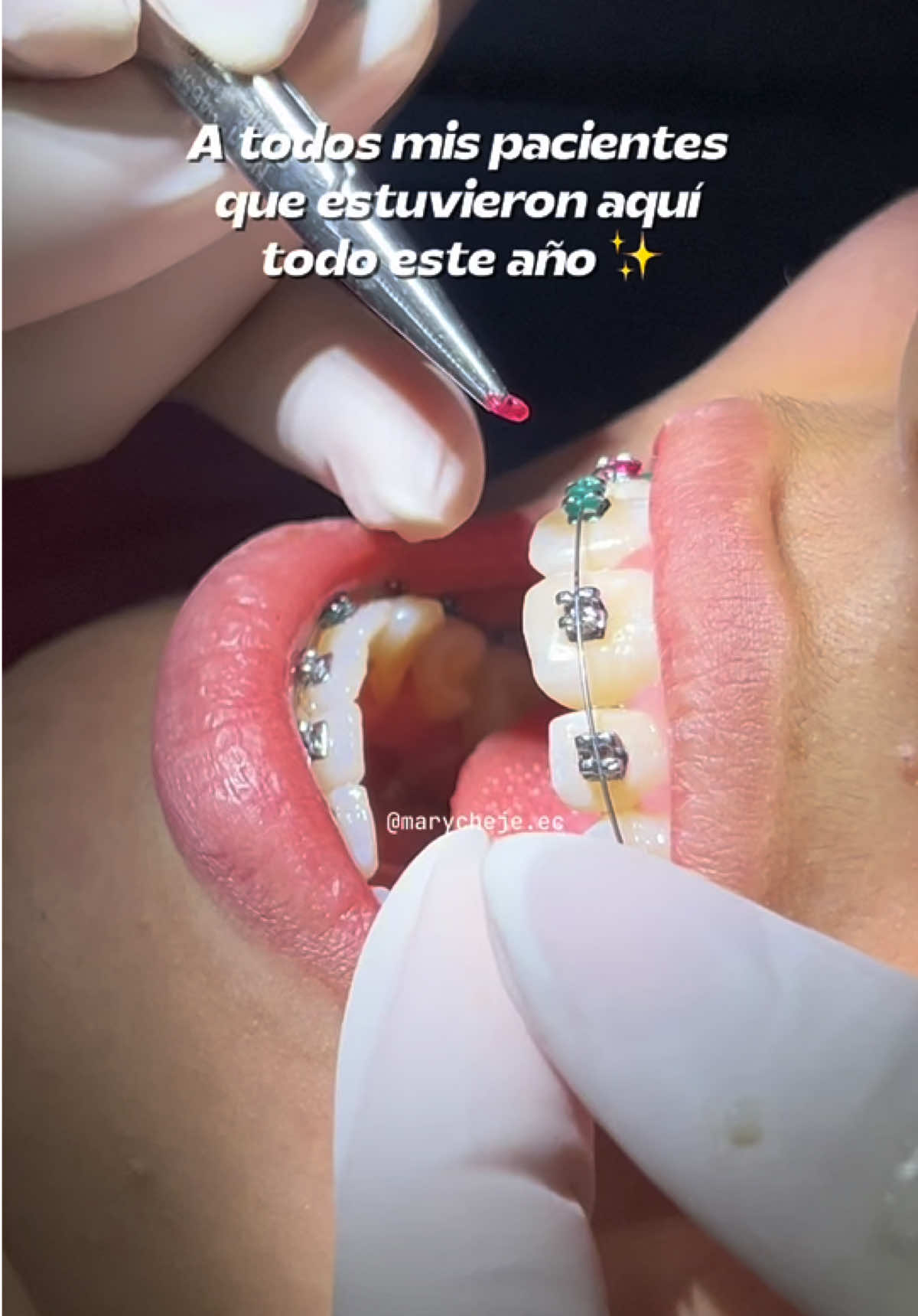 SIMPLEMENTE GRACIAS 🦷💫 #feliznavidad #amor #felicidad #gratitud Navidad #ortodoncia #ortodoncista #confianza #dentista #odontologo #sonreir #brackets 