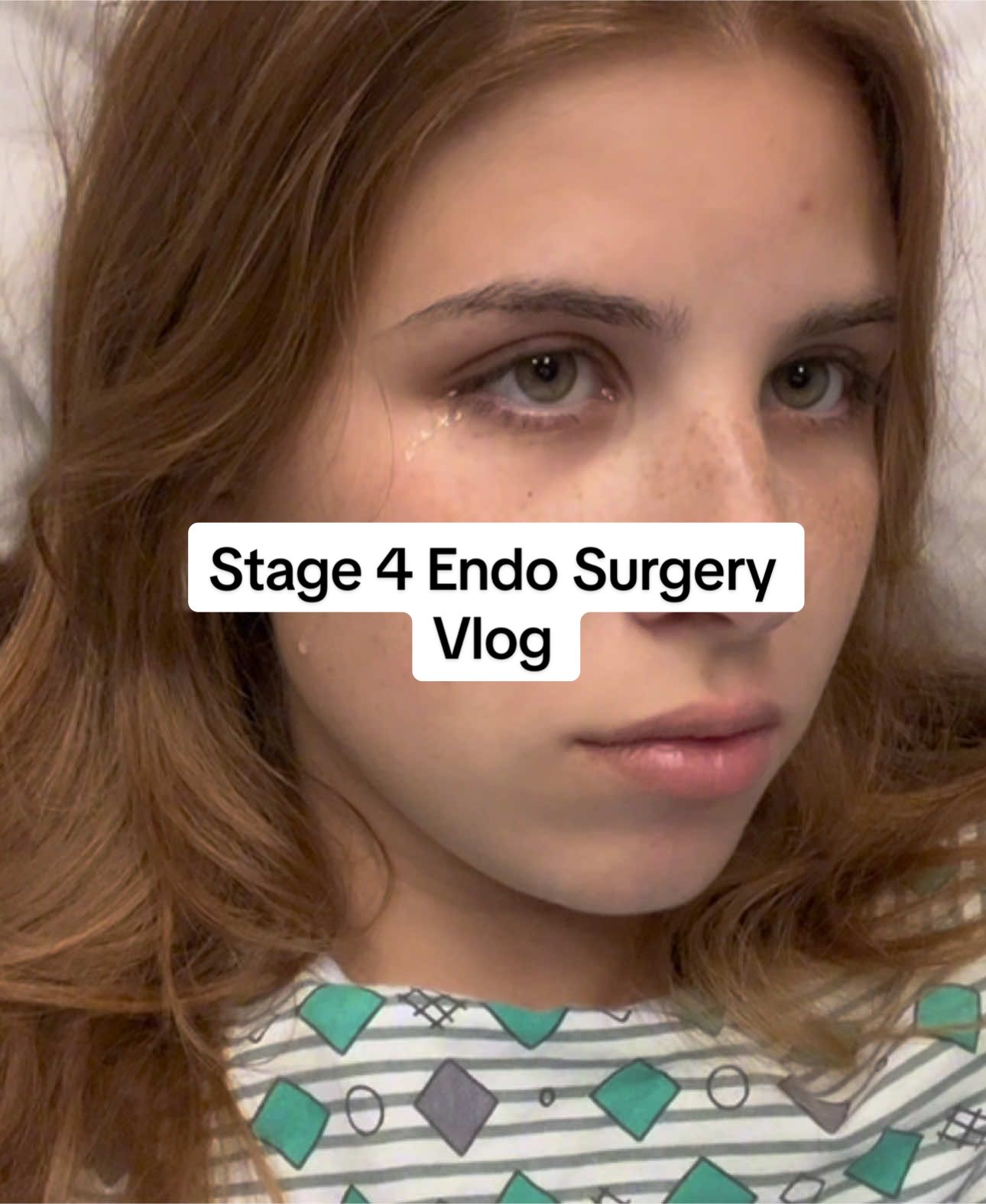 I got endometriosis surgery in march and finally posted the whole vlog on my youtube channel!! Just a reminder it’s not normal to pass out or throw up on your periods❤️ I will be making another video soon to answer any questions!!  ##endo##endometriosis##endometriosisawareness##dysmenorrhea##period##girlproblems##heath##endosurgery##endosurgery