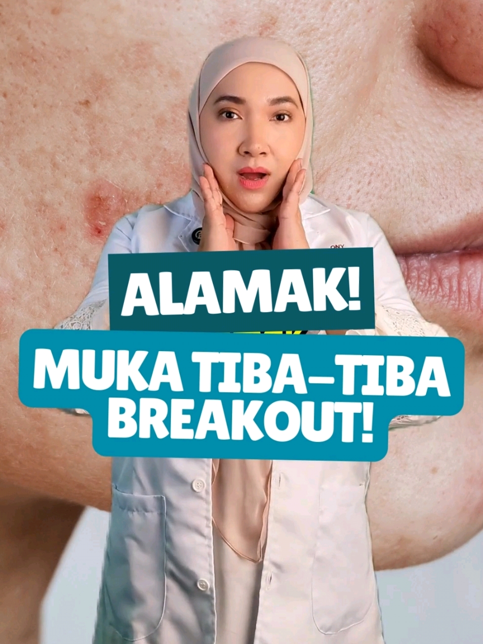 Alamak, muka breakout lepas pakai skincare baru? jangan risau ini mungkin sebabnya dan cara nak selesaikan!  #breakout #purging #redness #vitaminc #serum #vitamincserum #jerawat #kulitsihat #glowing #alwaysannona #annonapharmacy #skincaretips 