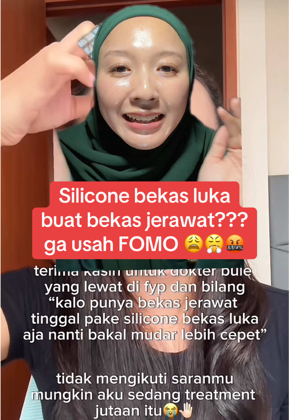 silicone bekas luka buat bekas jerawat?? yaaak tolong jangan fomo, selalu liat konteks yg full dan cross reference biar ga gampang termakan fomo dan konten fyp #skincaretips #skincareroutine #skinhacks #jerawat #acne #bekasjerawat 