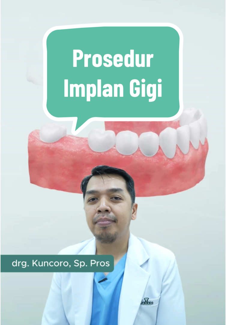 Seperti ini prosedur pemasangan implan gigi di Tanam! Menggunakan 𝐭𝐞𝐤𝐧𝐨𝐥𝐨𝐠𝐢 𝐈𝐦𝐩𝐥𝐚𝐧𝐭 𝐀𝐥𝐢𝐠𝐧𝐞𝐫, jadi minim bedah*. Tampilan dan penggunaannya juga seperti gigi asli. Gigi ompong? Yuk, book konsultasi di link bio! #GigiOmpong #ProsedurImplanGigi #TanamGigi #ImplanGigi #ImplanGigiTermurah #DigitalImplant