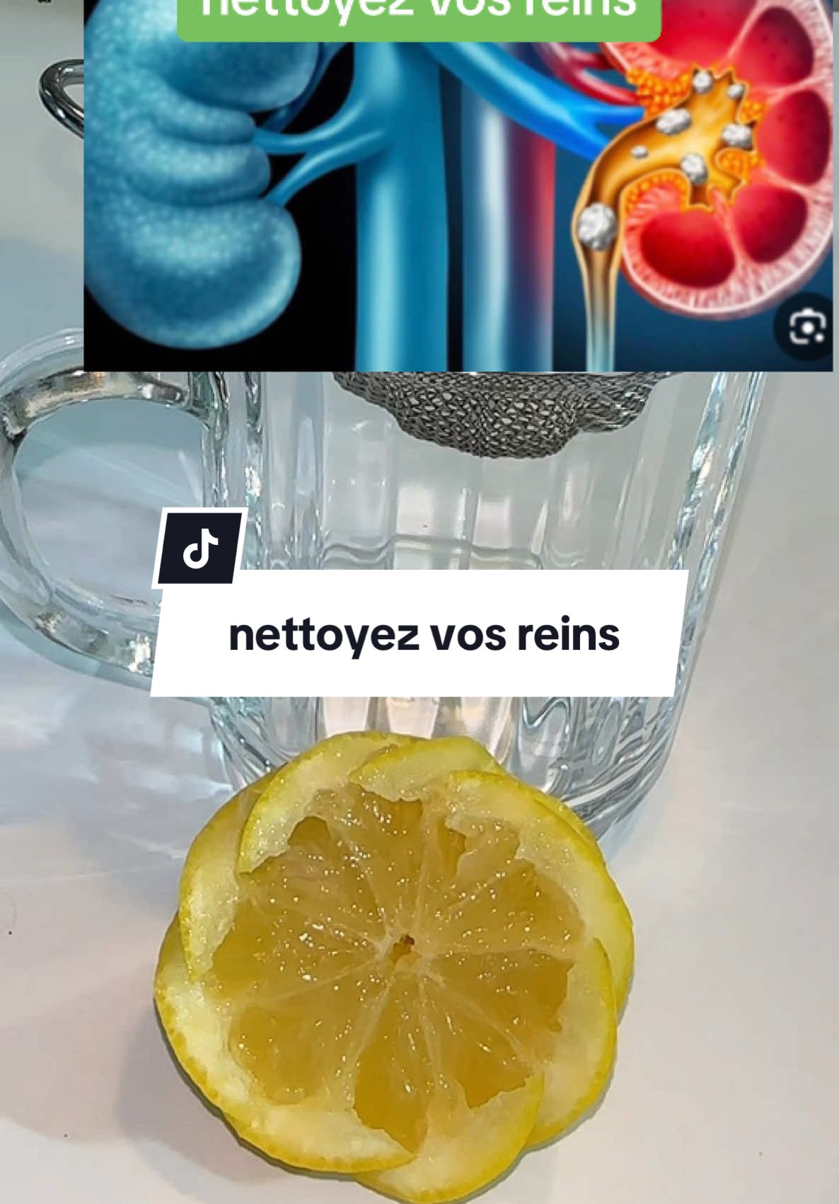 nettoyez vos reins#reins #detox #urine #calculrenaux #astucesanté #remediosnaturales #santé #médecinenaturelle #remèdesnaturels #remède #médecin #médecinenaturelle #boissondetox #pourtoii #fyp #foruyou #explore #forupage #tiktoksante #foryoupage❤️❤️ #tiktoksante #astuce  @وصفات  @وصفات  @وصفات 