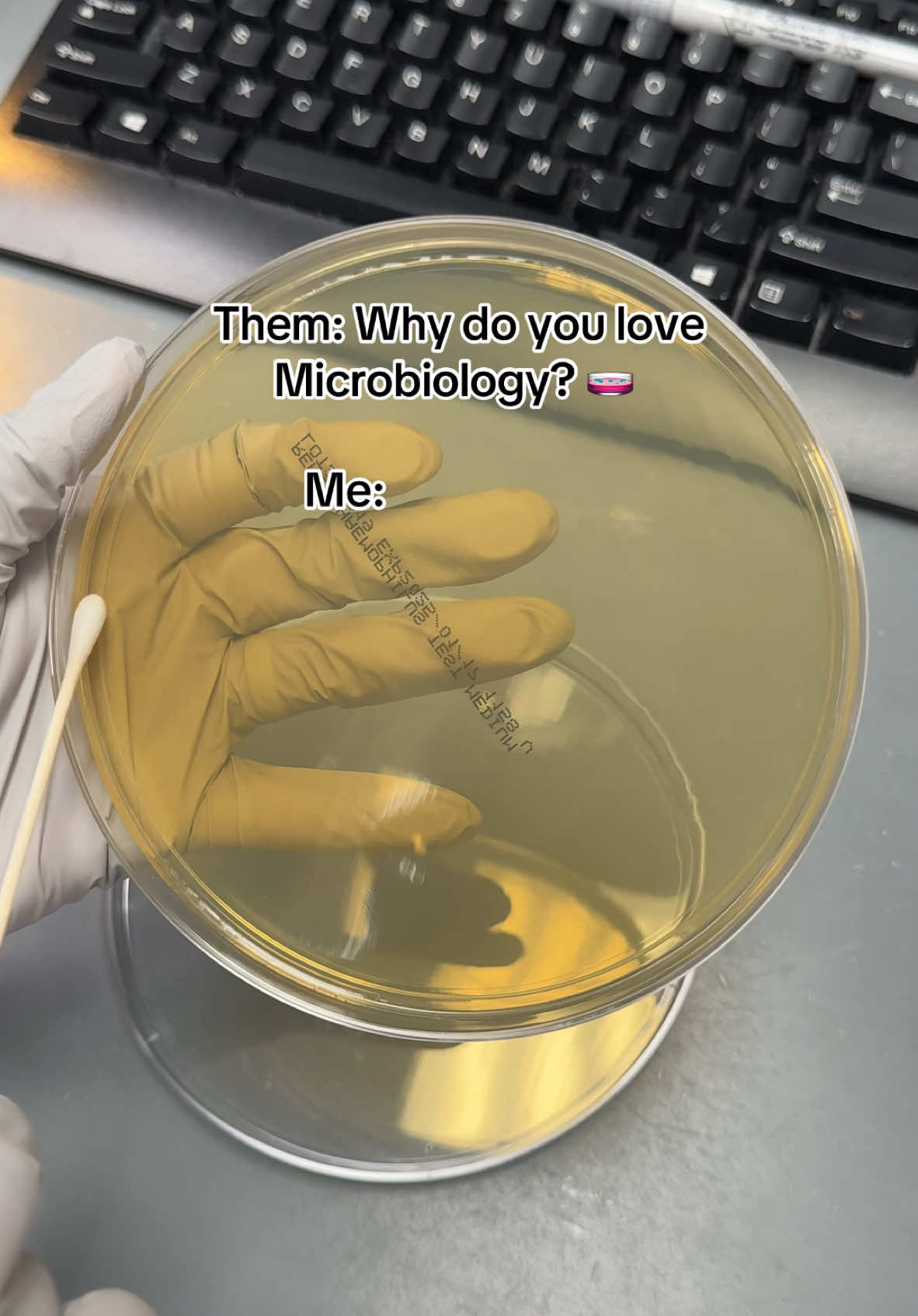 Yes!!! 🧫🦠 #microbiology #medtechtok #laboratory #fyp 