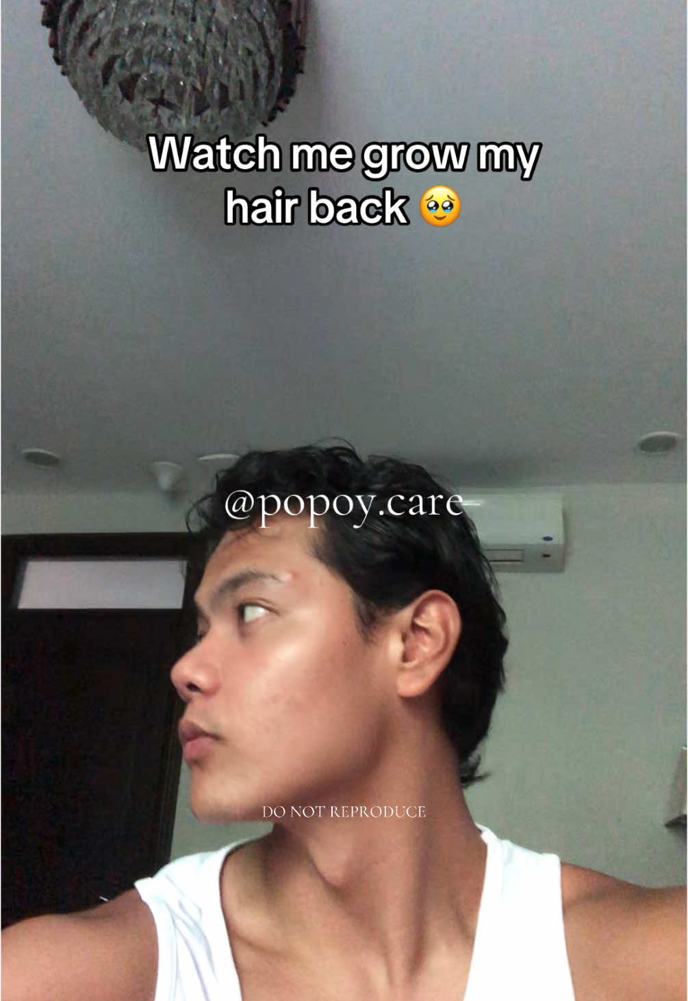 Di na panot next year 😅 Sana kayo rin  #hairgrow #haircare #hair #haircareroutine #hairtok #hairgrowth #hairproducts #hairproblems #hairgrowthjourney  #SelfCare #confidence #haircareproducts #hairstyle #balding #healthy #minoxidil #finasteride #biotin #alopecia #hairfall #sanaall #fyp 