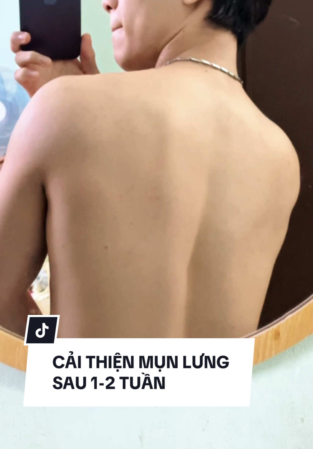 Cũng phải trải nghiệm cả tháng trời mới dám lên video đấy ae ạ, công nhận cải thiện nhưng phải tầm 1-2 tuần đấy..........#minhquanreview #reviewcotam#Abera#geltamAbera#suatamkhoqua#munlung#viemnanglong