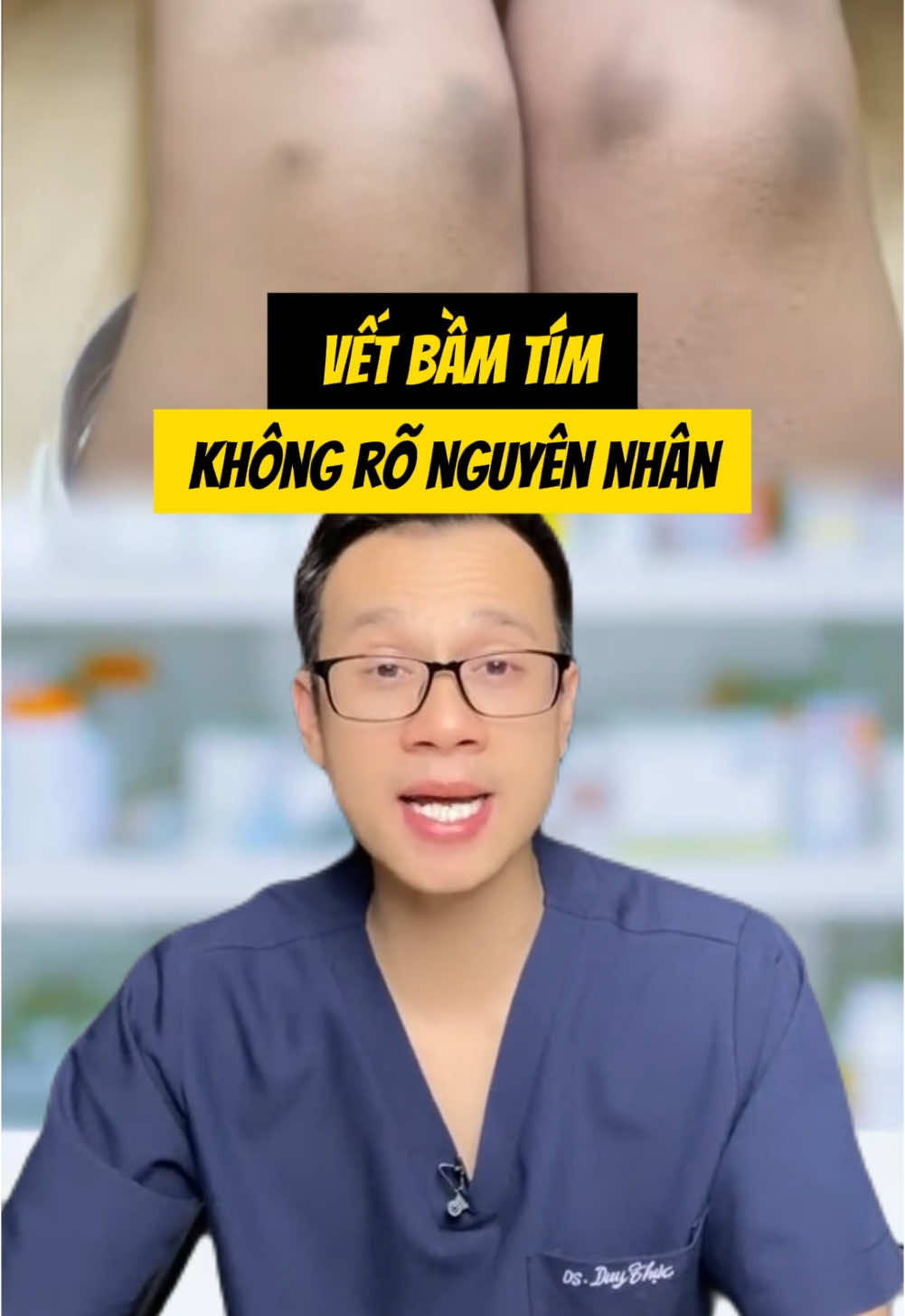 Hoá ra đây là nguyên nhân thật sự gây bầm tím👇