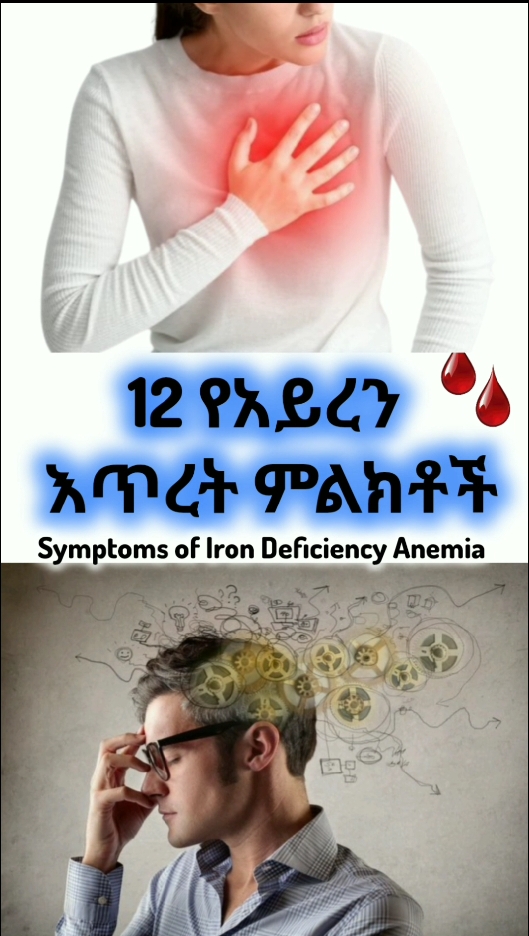 #anemia #የአይረንእጥረትምልክቶች #symptomsofirondeficiency #lowbloodlevel #symptoms #ጤና #የህመምምልክቶች #management #eritreantiktok🇪🇷🇪🇷habesha #eritreantiktok🇪🇷🇪🇷habesha #fyp #education #healthylifestyle #fetuntube 