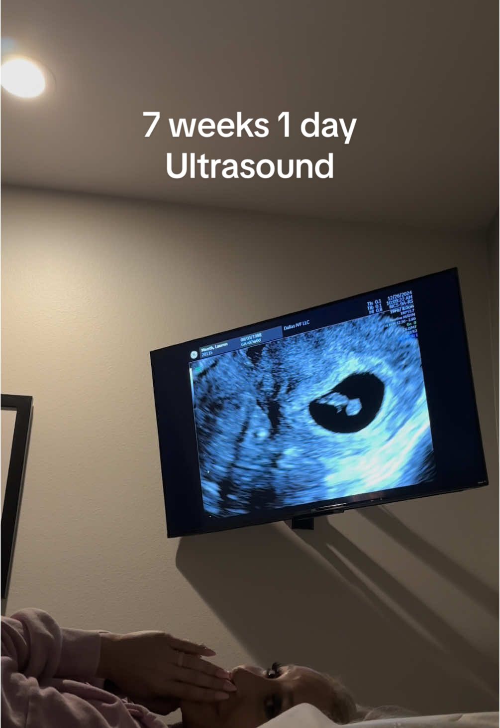 Got to see our baby for the first time today! Heart beat is 141 bpm and we are so incredibly grateful to God for this healthy baby! Grow baby grow! #ivf #embryotransfer #godisgood 