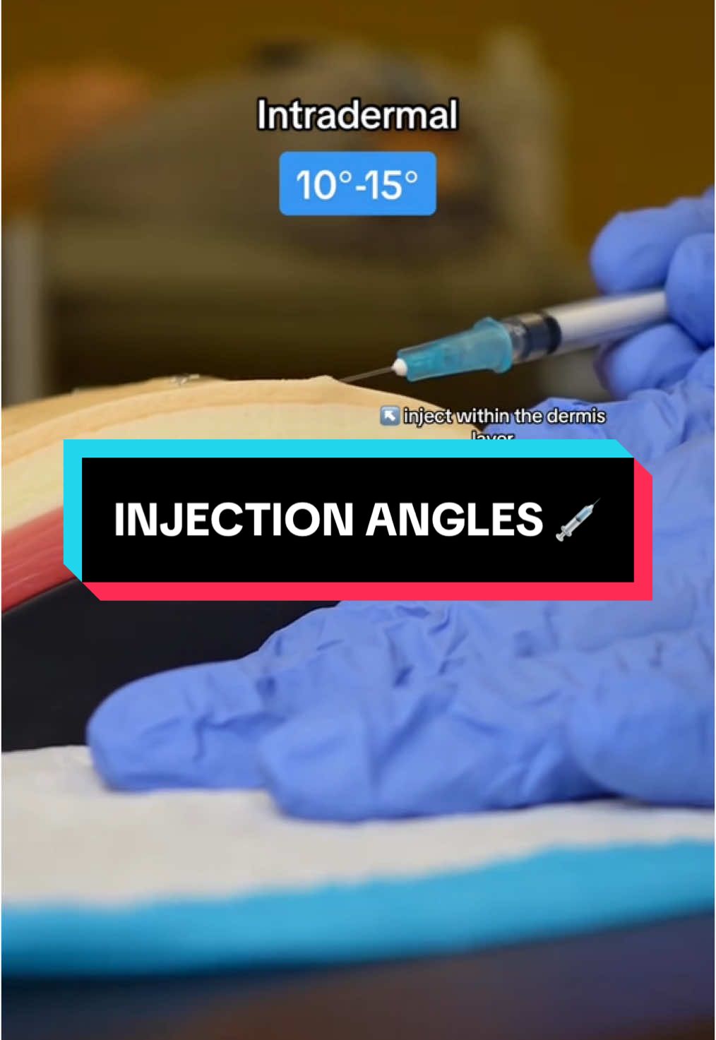 HEY NURSING STUDENTS ❗️ make sure you save this video of injection angles for next semester 😉 #injections #injectiontok #saveforlater #nursinghacks #nclex #nclextips #nursingstudent #studentnurse #medicalstudent #skillslab #studentnursehacks #nursesoftiktok #studentsoftiktok #christmaseve #merrychristmas #happyholidays #feliznavidad #christmashaul