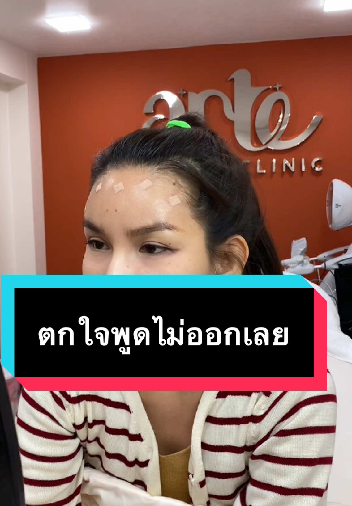 #เทรนด์วันนี้້ ตกใจหน้าตัวเอง พูดไม่ออกเลย ชอบที่คุณหมอทำให้ #artehouseclinic #artehouseclinicสาขารังสิต #หมอเบนนี่อาเต้เฮ้าส #Tiktoklooks #รีวิวบิวตี้ในtiktok🥀🌺🌍 #รีวิวบิวตี้ในtiktok #Tiktoklooks #ฟิลเลอร์หน้าผาก 