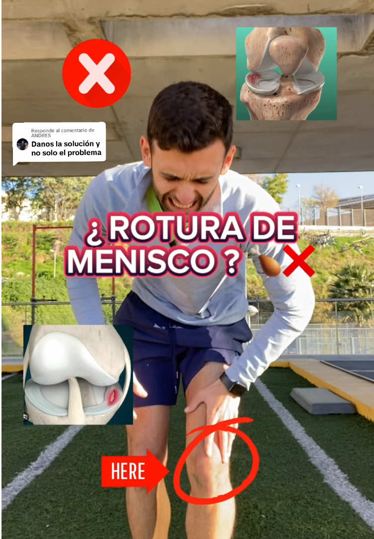 Respuesta a @ANDRES  😰 ¿Has sufrido una rotura de Menisco? ¿O lesión de Menisco? 💥 ⛔️ NO TE OPERES ⛔️ 🙌 Realiza estos 3️⃣ súper ejercicios para aliviar tu dolor y fortalecer tu rodilla. 🦵 ❌ NO normalices vivir con dolor, si has sufrido esta u otra lesión, contáctame. 📲 #lesionmenisco #menisco #meniscus #roturamenisco #dolorderodilla #rodilla #lesionrodilla #adrifisiofitness 