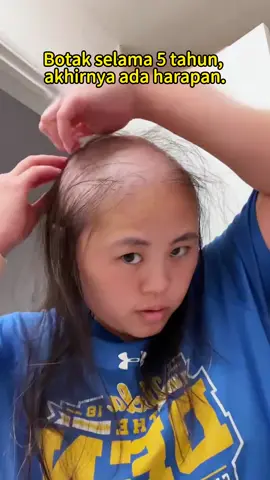 - [x] Jika anda juga menderita #rontokrambut ,rambut menipis,bercabang lebar,garis rambut surut,cobalah #antihairfall #shampoo ini #remimpi #remimpishampo 