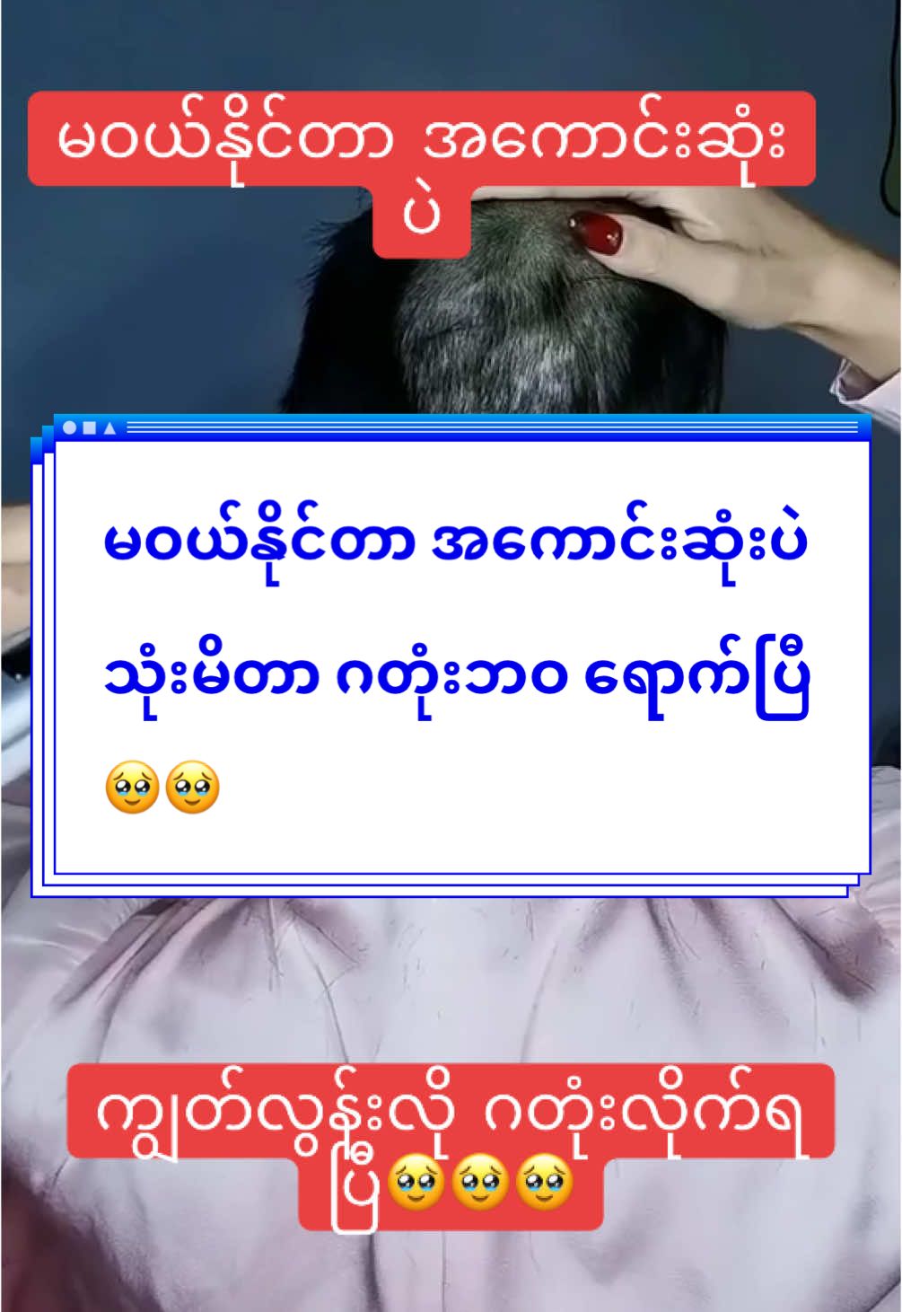 #မြင်ပါများပီးချစ်ကျွမ်းဝင်အောင်လို့🤒🖤 #တွေးပြီးမှတင်ပါ #ရောက်ချင်တဲ့နေရာရောက်👌 #ရောက်စမ်းfypပေါ် #fypシ #thankyou #thankb4youdo #trend #fyp #trend #1000kveiw🤘🏿🤘❤️🖤 #tiktokmarketplace #ရောက်ချင်တဲ့နေရာရောက်👌 #ဆံပင်ပြသနာရှိသူတိုင်းကြည့်ပေးပါ #thankb4youdo #hairstyle 