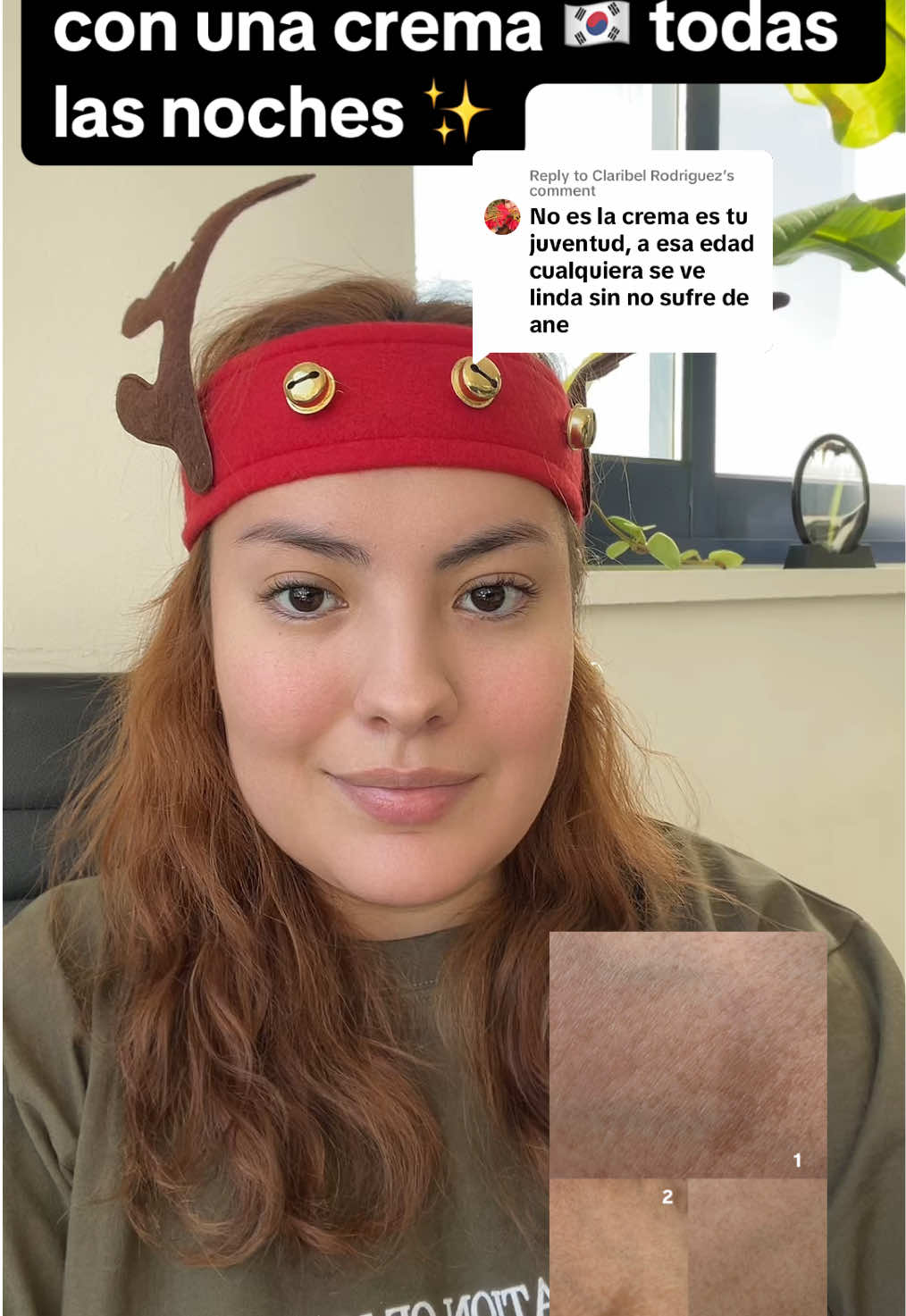 Replying to @Claribel Rodriguez me quite las manchas usando cremas coreanas, si lo intentas sabrás de que te estoy hablando 👋✨ #niacinamide #pielsana #pielseca #hiperpigmentacion #bonita #bonita #estrias #lineasfinas #arrugas #amorpropio #finelines #allskintypes✊🏻✊🏼✊🏽✊🏾✊🏿 #cica #acidohialuronico #pieldeseda #piel #niacinamida #centellaasiatica #hyaluronicacid #collagen 