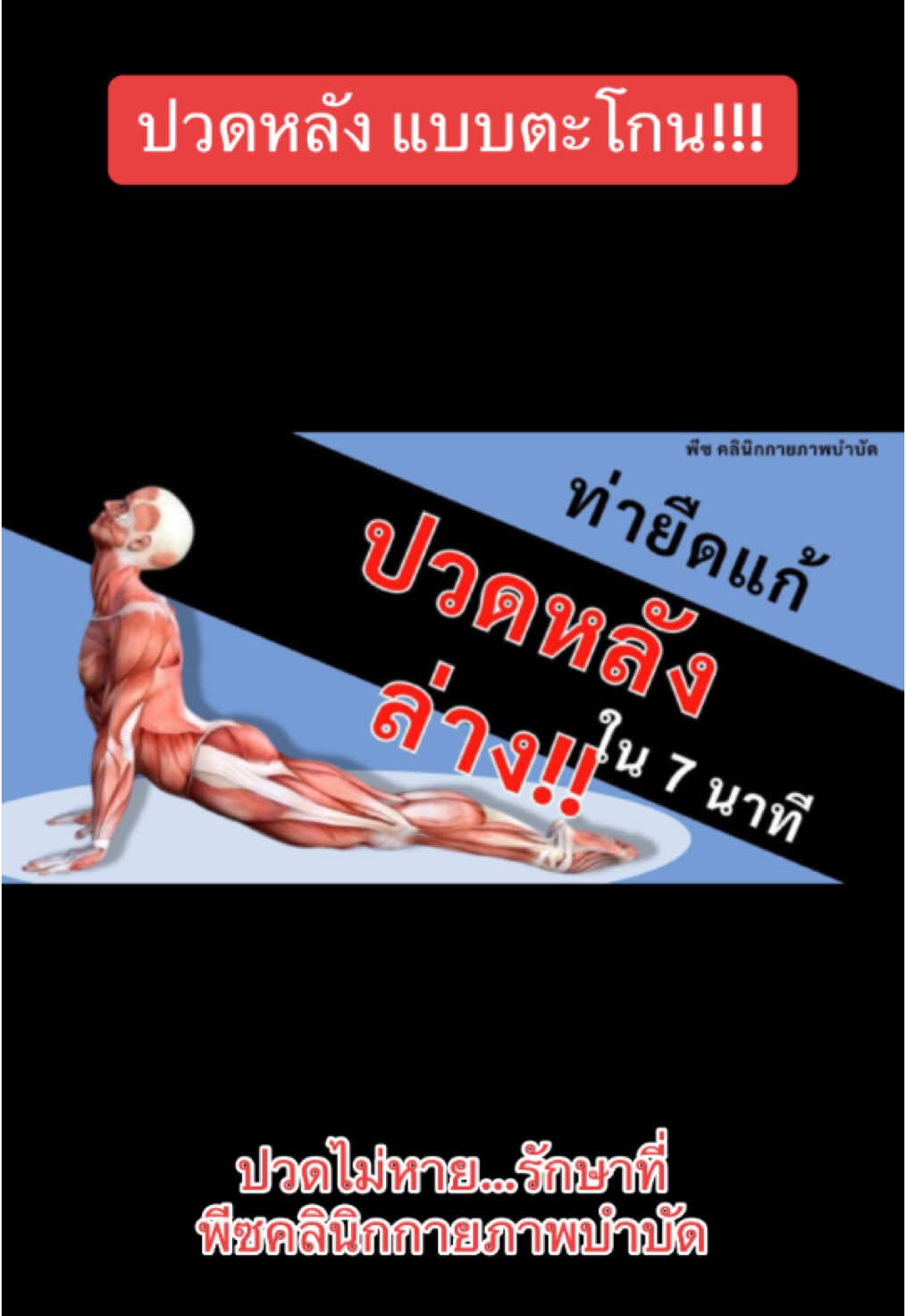 ปวดหลัง แบบตะโกน!!! #ปวดหลัง #ปวดเอว #ออฟฟิศซินโดรม #พีซคลินิกกายภาพบําบัด#มนุษย์ตึง#TikTokUni#รักสุขภาพ#tiktokhowtoรู้เลย#tiktokการกีฬา #ที่สุดแห่งปี #ความรู้แห่งปี2024