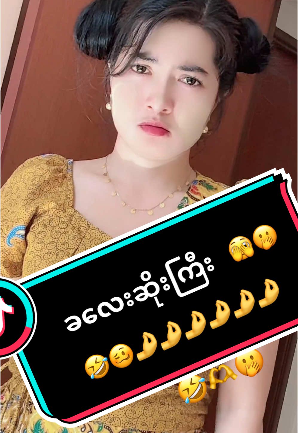 အယ့်ဆို..ကတိပေး#😂😂😂 #foryou #မြင်ပါများပြီးချစ်ကျွမ်းဝင်အောင်လို့😜 #tiktokmyanmar #ရောက်ချင်တဲ့နေရာရောက်👌 #စင်ကာပူရောက်မြန်မာမလေး🇲🇲😘🇸🇬 #2รูปตึงๆ #สปีดสโลว์ #สปีดสโลว์ สโลว์สมูท 