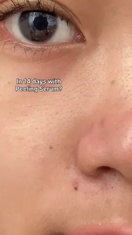 2 minggu yang sangat worth it! 😭🩵 #CleoraBeauty #eksfoliasi #redsaviour #KulitkuCeritaku 