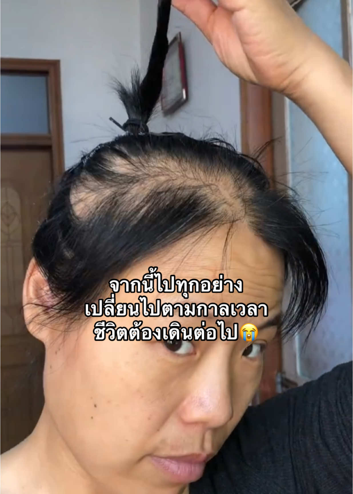 ชีวิตต้องเดินต่อไป😭 ##พิกัดตะกร้าหน้าโปรไฟล์##ผมร่วง##ผมดกผมหนา##เซรั่มปลูกผม##โทนิคชบา##แชมพูชบา##fyp