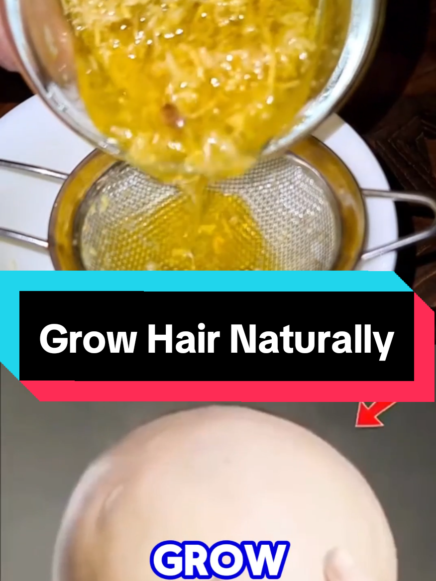 You'll grow #hair where you don't have it. #growhair #hairgrowth #hairloss #remedy  #haircareroutine #haircare #Recipe  Don't use this hair treatment every day because it makes your hair long and soft in just 7 days. #naturalremedy #naturalremedies #recipes #naturalrecipes 