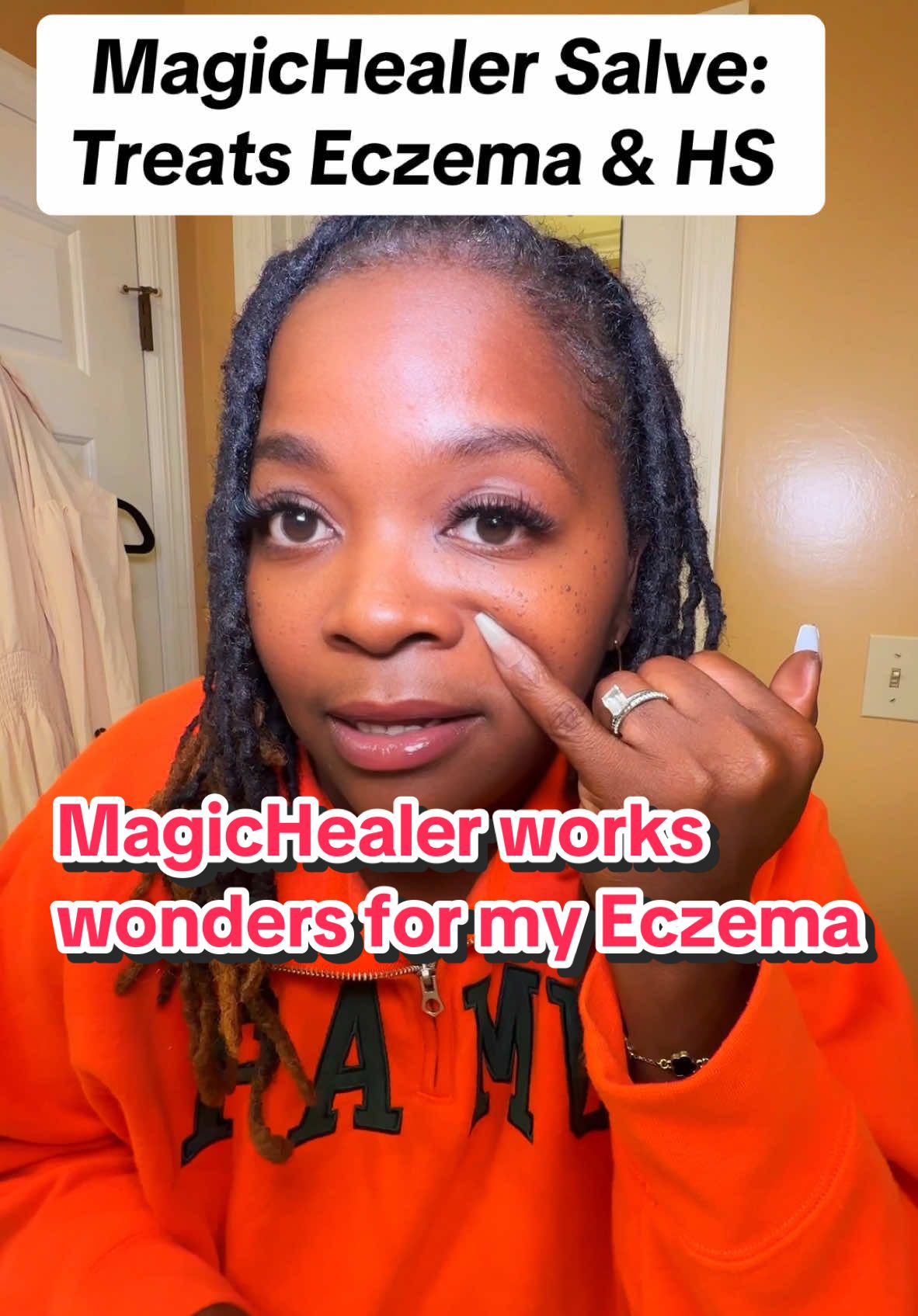 This Magic Healer has worked wonders for my eczema and glucose skin issues! #magichealer #Eczema #HSwarrior #glucose #skinhealer #skincare #flareups