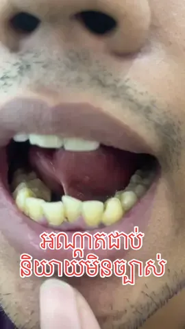 #Telegram089590007 ##ត្រចៀក #ច្រមុះ #បំពង់ក 