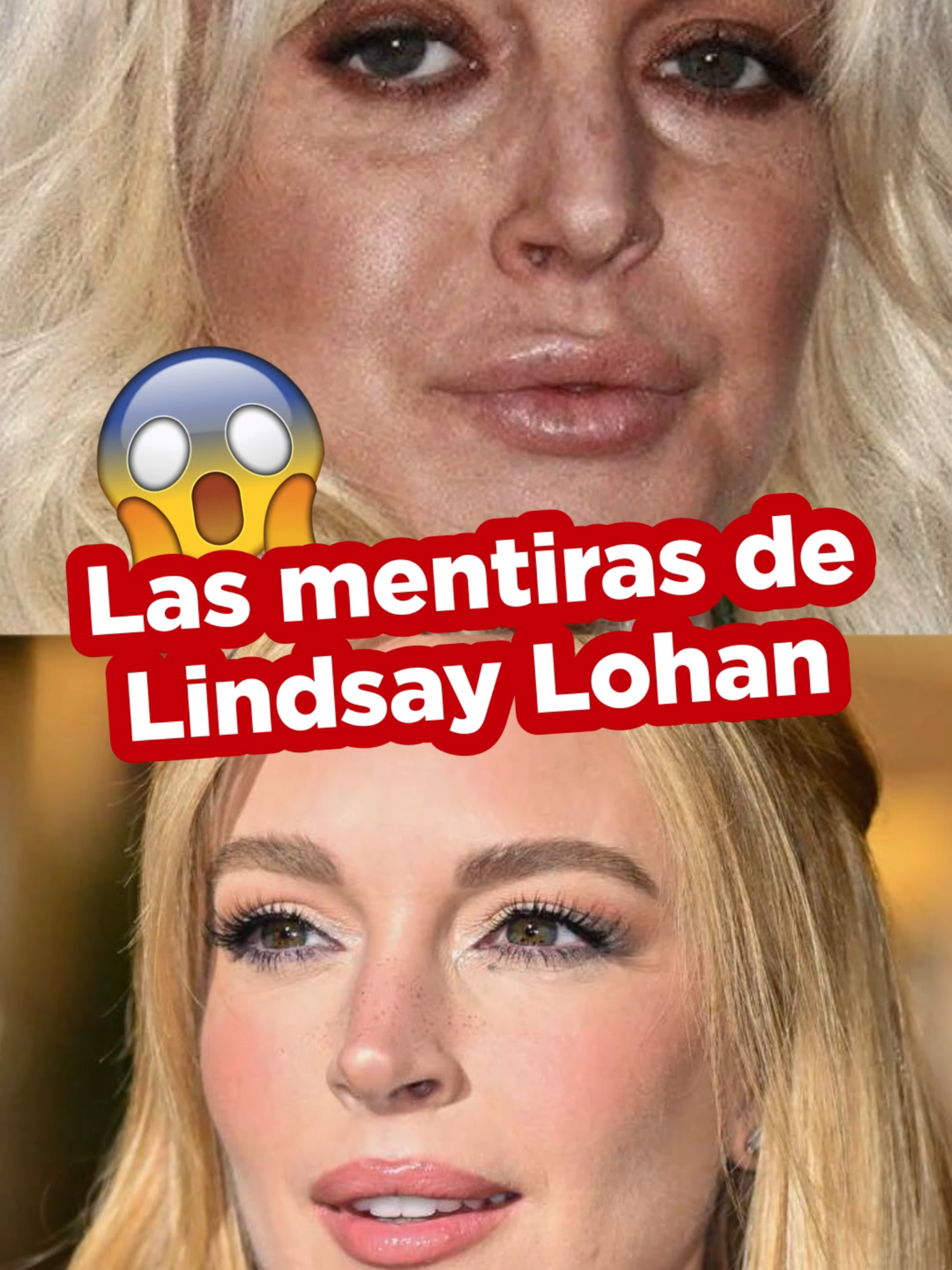 ¡Los secretos de Lindsay Lohan!🤫 El cambio que vimos en Lindsay Lohan nos ha dejado sorprendidos a todos. Por ello, hoy les comparto mi opinión sobre este increíble caso.  ▶ Presta atención al video y déjame un comentario. ¿Deseas rejuvenecer tu rostro? Te espero en consulta. 👩🏻‍⚕️ 👉Mayor información: https://wa.me/message/KZE3MV5BOYSPJ1 📲 Whatsapp 989121842 🏥 Avenida del Pinar 152 Piso 5 en Surco 👩‍⚕ Derma Láser KPW, con lo último en tecnología Láser, el personal de siempre y los mejores protocolos de bioseguridad. . . . #LindsayLohan #Manchas #Bioestimuladores #HabitosSaludables #TratamientoLaser #Dermatologa #Dermatologia #DermaLaserKPW #DraKaterynPerezWillis #lima #peru🇵🇪