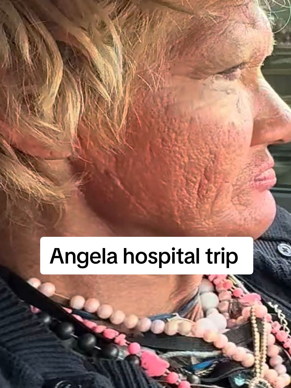 Angela hospital trip #angela #angelaupdate #angelahomeless #talesfromthestreets #helpinghomeless #homelessness #homeless #interviewhomeless #art 