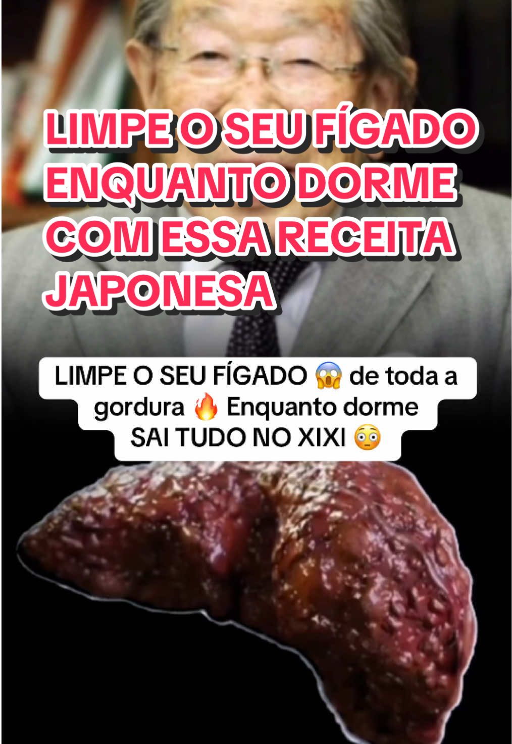 Médico com mais de 100 anos explica o segredo para limpar o seu fígado. #saude #receitas #obesidade #vidasaudavel #emagrecimento 