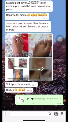 #teint #kinto #visibilité #blanche 