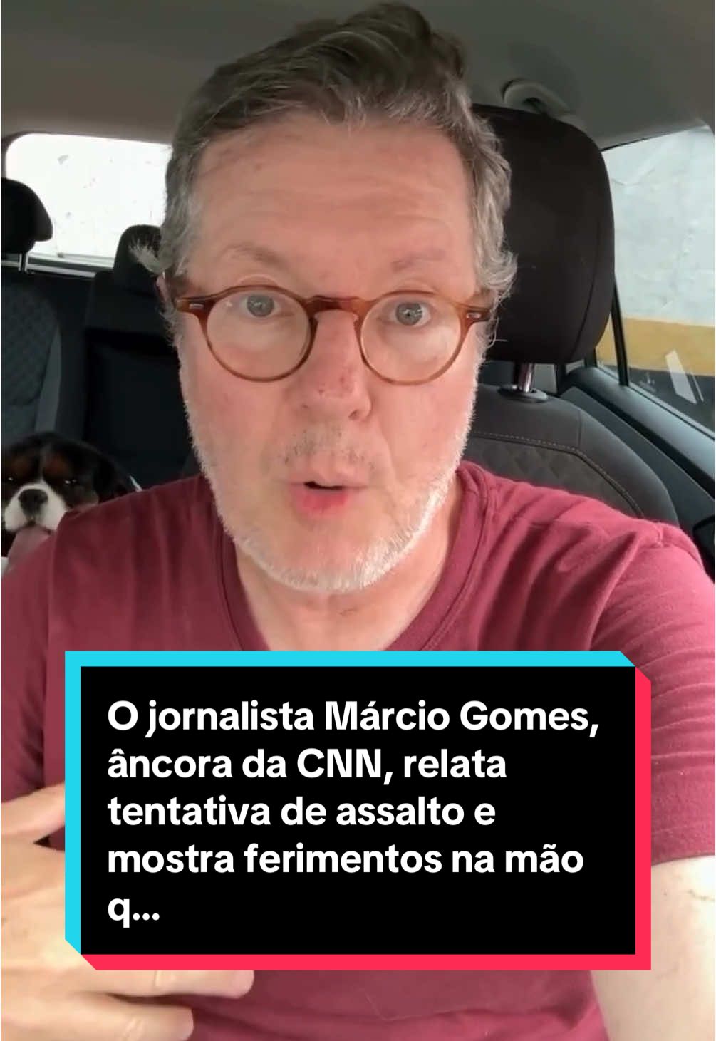 O jornalista Márcio Gomes, âncora da CNN, relata tentativa de assalto e mostra ferimentos na mão que sofreu #marciogomes #cnn #saopaulo 