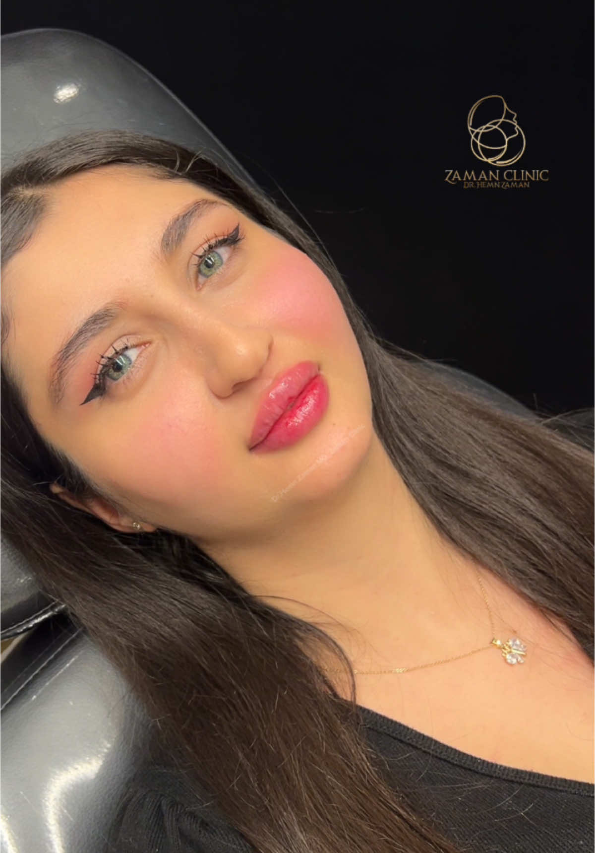 Lip filler🫦 #zamanclinic  07702281313 07512281313 #zamanclinic #drhemnzaman #fyp #foryoupagе #kurd #kurdistan #sulaymaniyah #hawler #kirkuk #chamchamal #zaxo #amedi #ranya #qaladze #explore #soran #halabja #baghdad #suadiarabia #lebanon #egypt #istanbul #mardin #dyarbakr #alanya #antalya #uk #russian #usa #beauty #aesthetic #dermatologist #pharmacy #routine #face #facial #medicine #babyface #peeling 