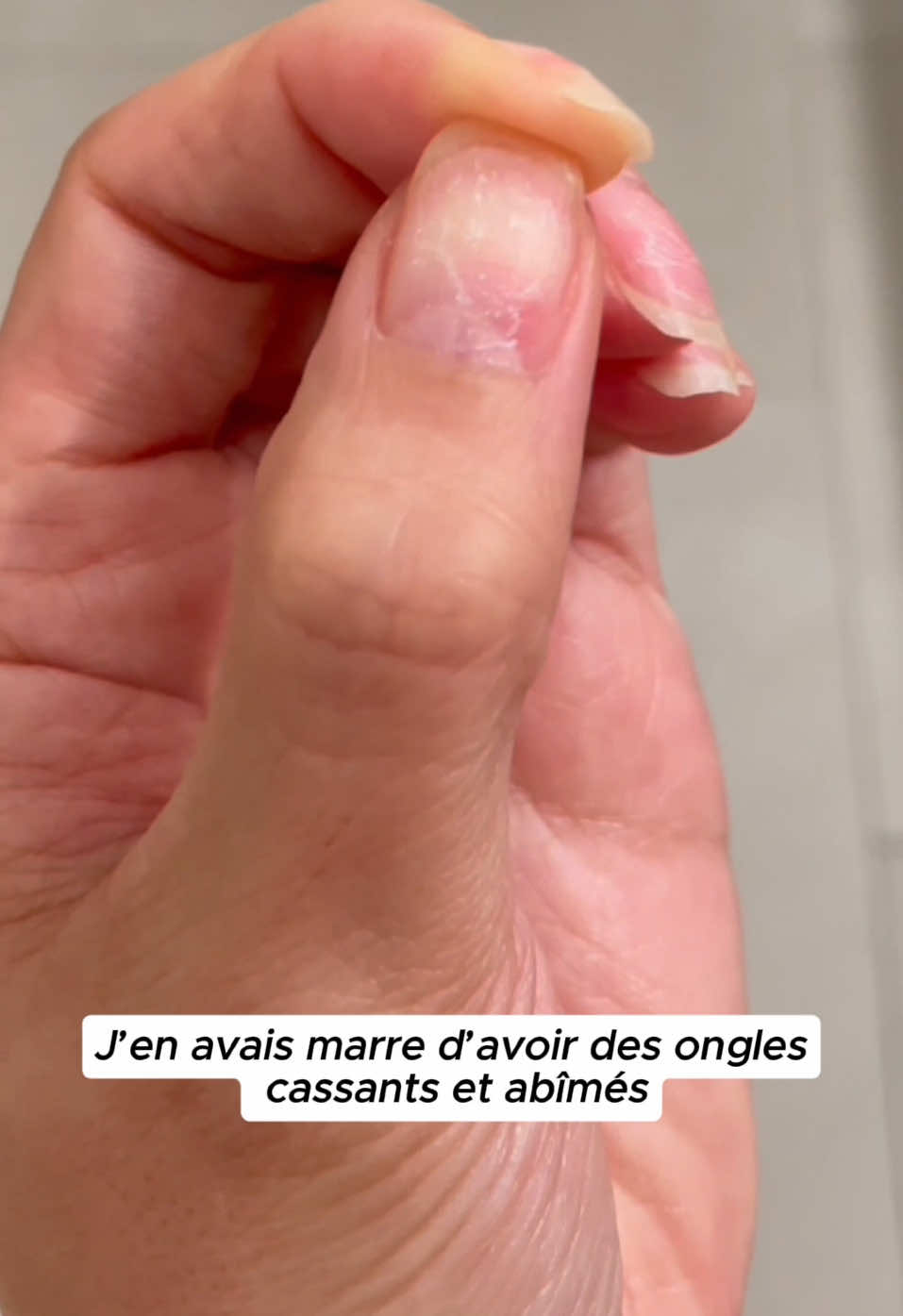 Dis adieu aux ongles abîmés et ternes grâce à notre sérum révolutionnaire ! Enrichi en +20 huiles naturelles et en vitamines B, C, E, il est spécialement conçu pour transformer tes ongles : ✨ Ils poussent plus vite ✨ Ils deviennent plus forts ✨ Ils retrouvent leur éclat naturel 🌟 Pourquoi c’est fait pour toi ? 	•	Résultats visibles dès 7 jours. 	•	Une formule 100 % naturelle, facile à appliquer. 	•	Parce que prendre soin de soi, c’est aussi glow-up jusqu’au bout des doigts. Ne laisse plus tes ongles attendre. Ne rate notre offre limitée jusqu’à minuit : 1 ACHETÉ = 1 OFFERT jusqu’à MINUIT !! Découvre ton nouveau secret beauté sur : 𝘄𝘄𝘄.𝗴𝗹𝗶𝘇𝗮𝗯𝗲𝗮𝘂𝘁𝘆.𝗰𝗼𝗺  📦 Livraison rapide & satisfaction garantie ! #ongleslong #onglenaturel #onglesaddict #onglesnaturels #onglegel 