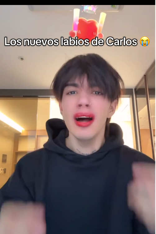 Los nuevos labios de Carlos #carlosalberto #caslos #ohohoh #humor #carlos 