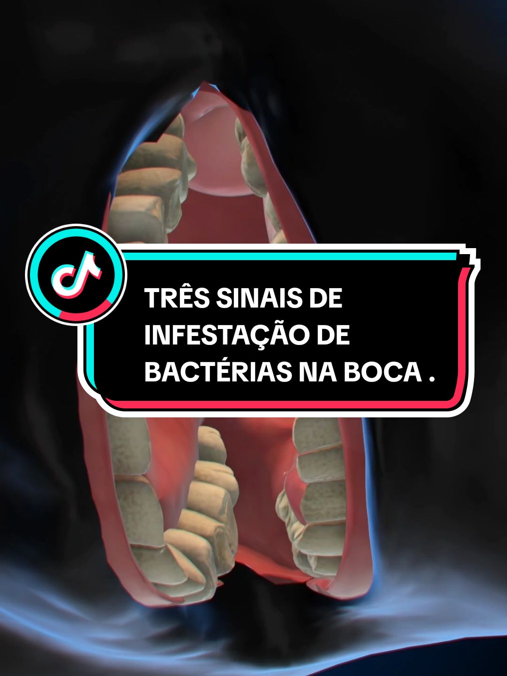 TRÊS SINAIS DE INFESTAÇÃO DE BACTÉRIAS NA BOCA ..