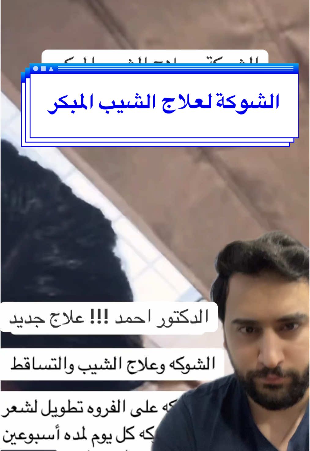٢ في واحد التساقط والشيب