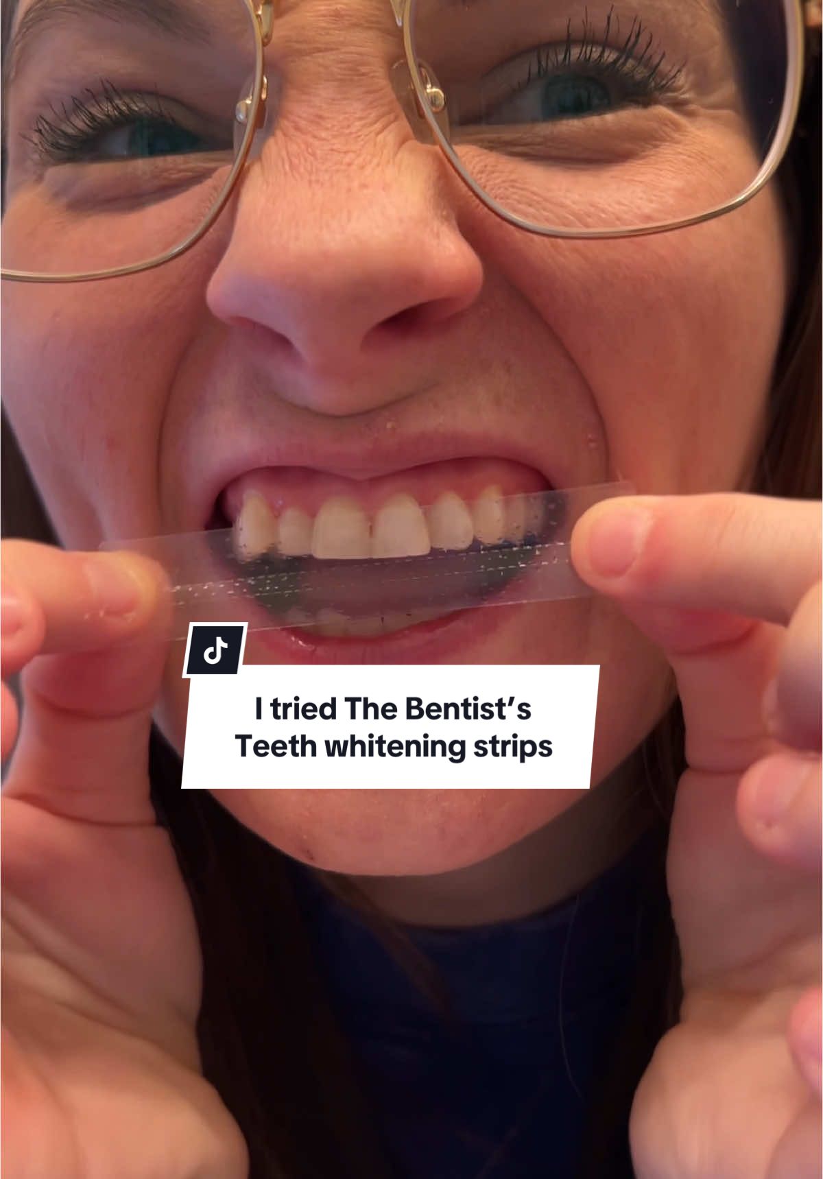 If @The Bentist / Orthodontist 🦷 makes a product, you KNOW it’s going to work. I’m so excited that I finally found a whitening strip that doesn’t hurt my sensitive teeth! #lumismart #thebentist #teethwhitening #whiteningstrips #GlowUp 