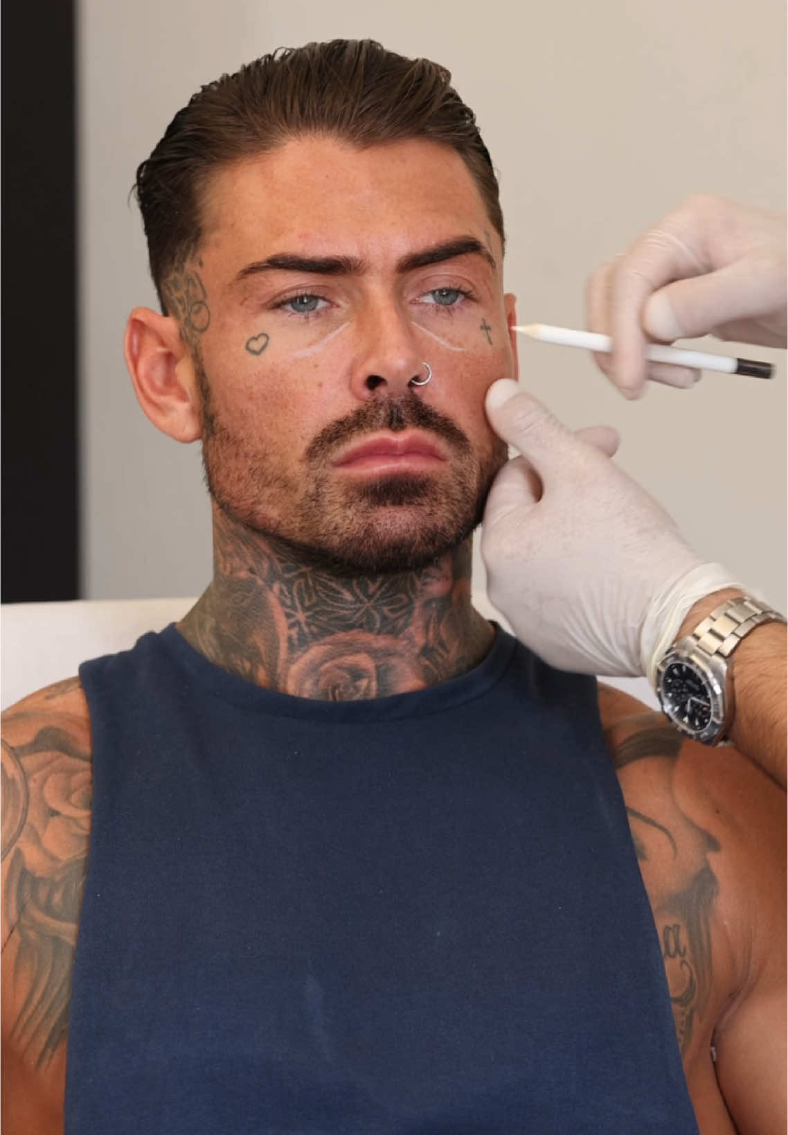 Say Goodbye to Tired Eyes with Tear Trough Fillers! Tear trough fillers are a non-surgical treatment designed to reduce under-eye hollows, dark circles, and that constantly ‘tired’ look. By using dermal fillers, we can restore volume, smooth out the under-eye area, and give you a refreshed, youthful appearance in just one session. ✅Quick Treatment ✅ Minimal Downtime ✅ Instant Results Feel confident and bright-eyed every day! Book your consultation now and let us help you look as vibrant as you feel. 📲 DM us to book an appointment or learn more! #ModelLook #MaleEnhancement #JawlineGoals #ConfidenceBoost #NonSurgical #FillersForMen #AestheticJourney #fillers #fyp #viral #looksmax #model #teartroughfiller 