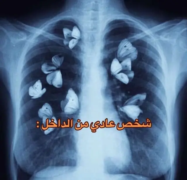 #الاردن #فلسطين #سوريا #السعودية #fyp #اكسبلور 