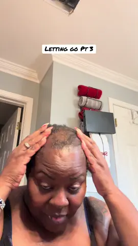 #baldbaddie #alopecia #blackbaldwomen #blackbaldwomenmatter #shavedhead #baldbeauty 