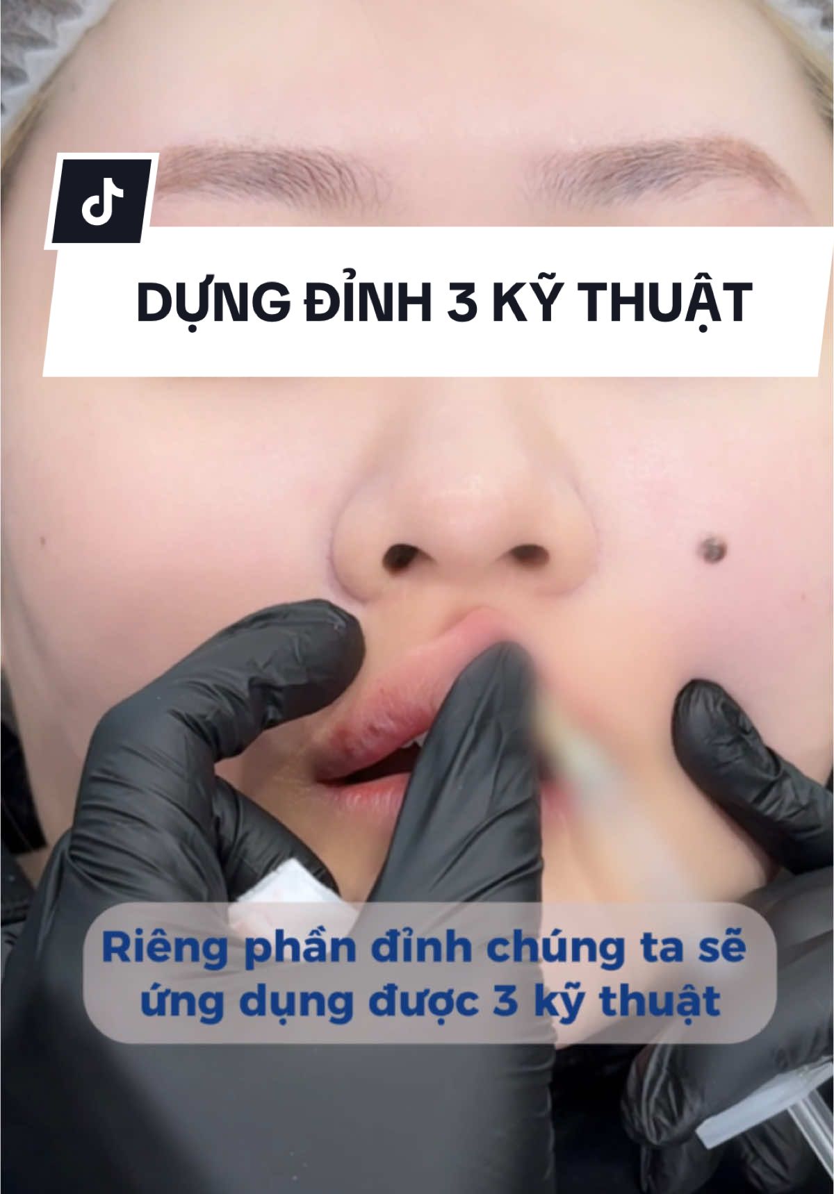 3 kỹ thuật dựng đỉnh và so sánh kết quả 👉 #hadofiller #hanoi #saigon #lumigroup #hocvienlumi 