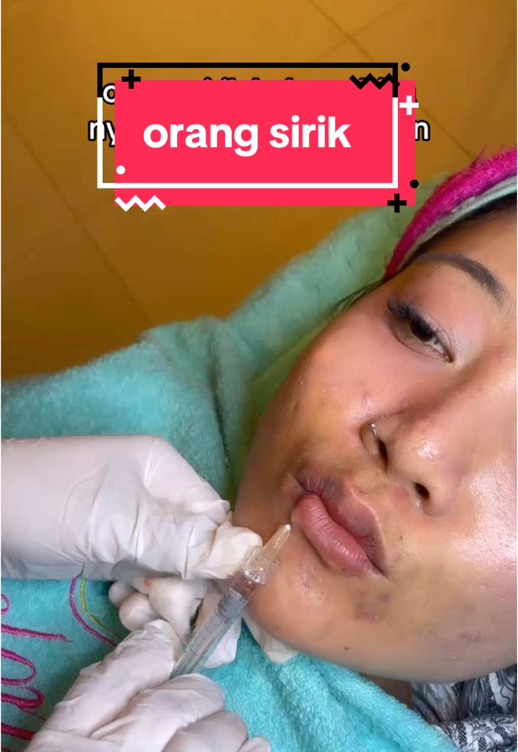 bahaya boi #fyp #infuswhitening #suntikputih #klinikkecantikanbekasi #delonabekasi #mancunginhidung #klinikkecantikan #delonaaesthetic #tarikbenang #delona #facial #delonasc #ramadhan #benanghidung #botox #aestheticclinic #resolusi2025 #fillerbibir #sexylips #promoakhirtahun #newyearnewlook 