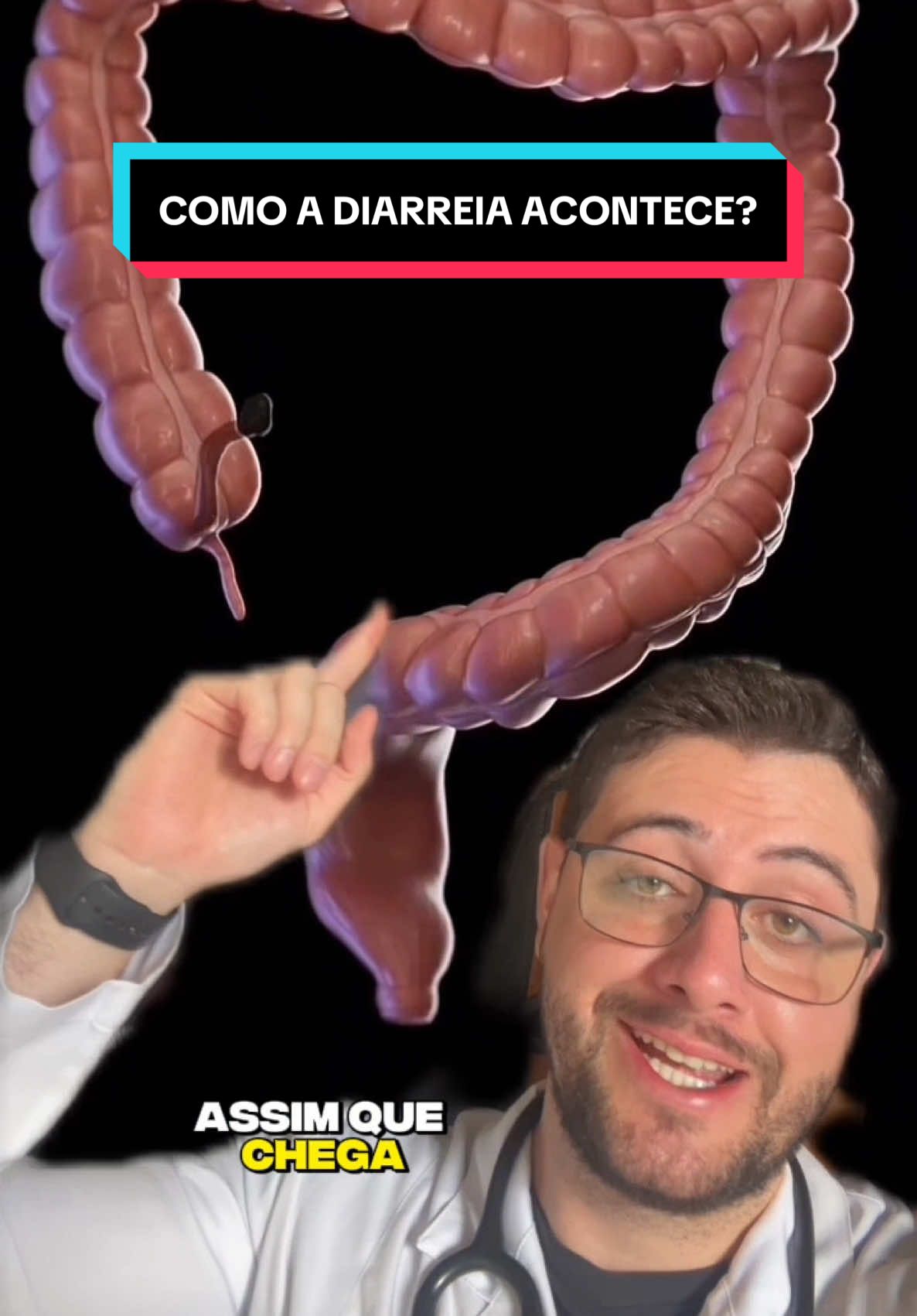 COMO A DIARREIA ACONTECE? #curiosidades #curiosidadesmedicas #intestino #fezes #medico #medicina