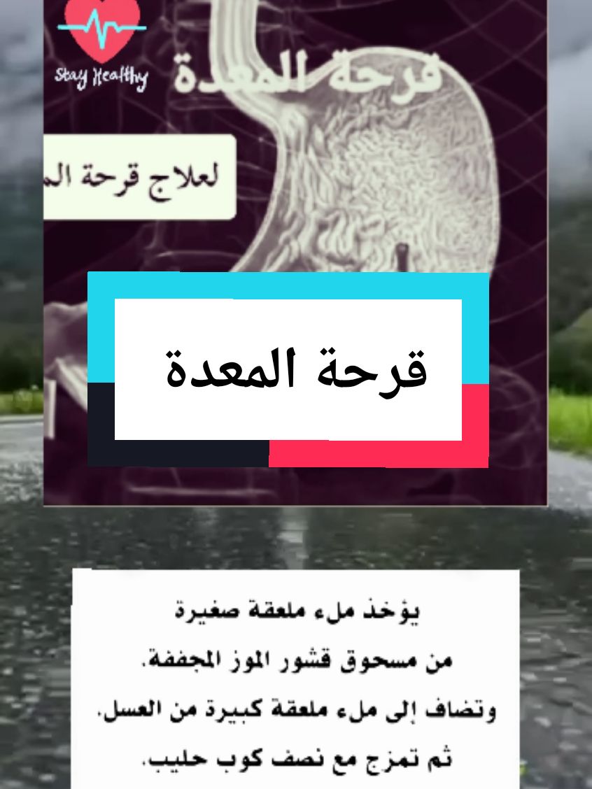 علاج قرحة المعدة #طبيب_تيك_توك #علاج_طبيعي #علاج_فيزيائي_منزلي #طب_صيني #علاج_بالاعشاب_الطبيعية #صحة_عامة #طب #نصائح #نيم #معلومات_مفيده #فوائد #منارة_العلم🥀 #معلومات_طبية #fyp #viralllllll #foruyou #for 