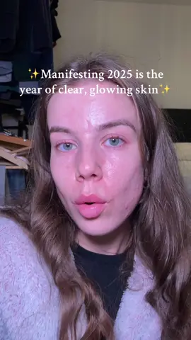 2025 will be the year #acne #manifest #clearskin #1stofthemonth 