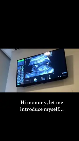 Surprise It’s A….. 🍼🐣