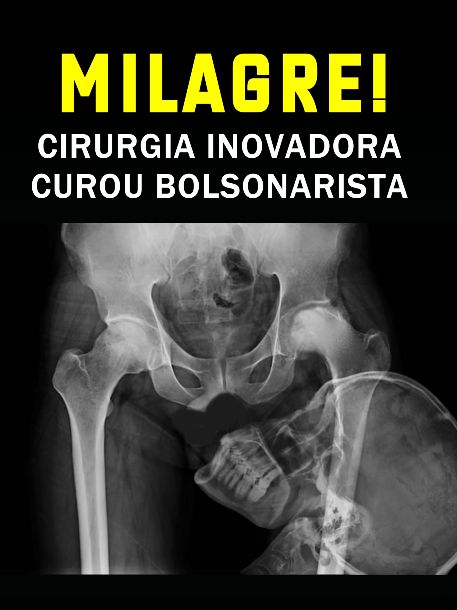 MILAGRE!! #notícias #policial #natuzanery #natuza #bolsonaronacadeia #lulapresidente #fatoscuriosos #vídeosengraçados #pegadinha #prisão #alexandredemoraes #feliz2025 #felizanonovo #comoganhardinheiro #michellebolsonaro #bozo #ponte #medicina #cirurgia