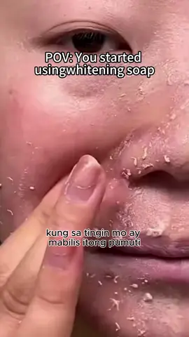 Niacinamide whitening soap can not only remove mites and acne, but also whiten the skin. Sisters who have not used it must try it#turmericandkojicacidsoap #clarifyingsoap #turmericsoap#turmericskincare #skincare #kojicacidsoap #brighteningbar#brighteningbarsoap #soap #darkspots #acnescars#hyperpigmentation #type #foryou #pypage*/#tiktokshop#hyperpigmentation #armpits #darkarmpits##VGO#vgobeauty#TikTokShop 