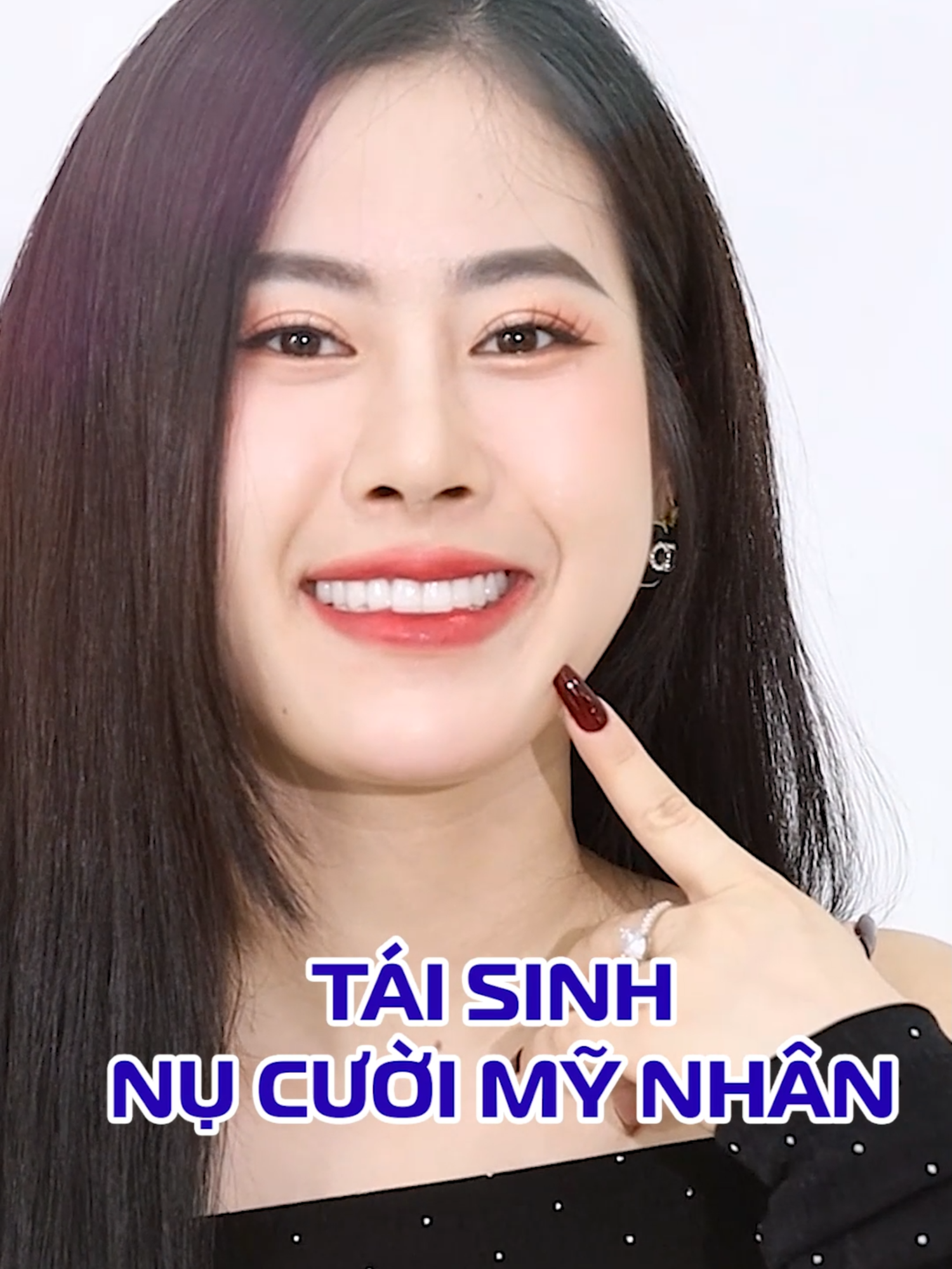 CHỈ 24H - TÁI SINH NỤ CƯỜI MỸ NHÂN. Bạn Phương Thảo từng “phủ sứ nano” (nhựa composite) gặp tình trạng: Răng kênh cộm, sứt mẻ gây viêm nha chu nặng, đau nhức cả hàm, khó ăn nhai và đã được bác sĩ giải cứu thành công. Cùng chiêm ngưỡng nụ cười mới với hàm răng chắc khỏe của cô nàng nhé! #nhakhoa #rangsuthammy #thammyrangsu #tutin #toasang #phaidep #nucuoi #lamdepdontet #thammy #vuikhoemoingay