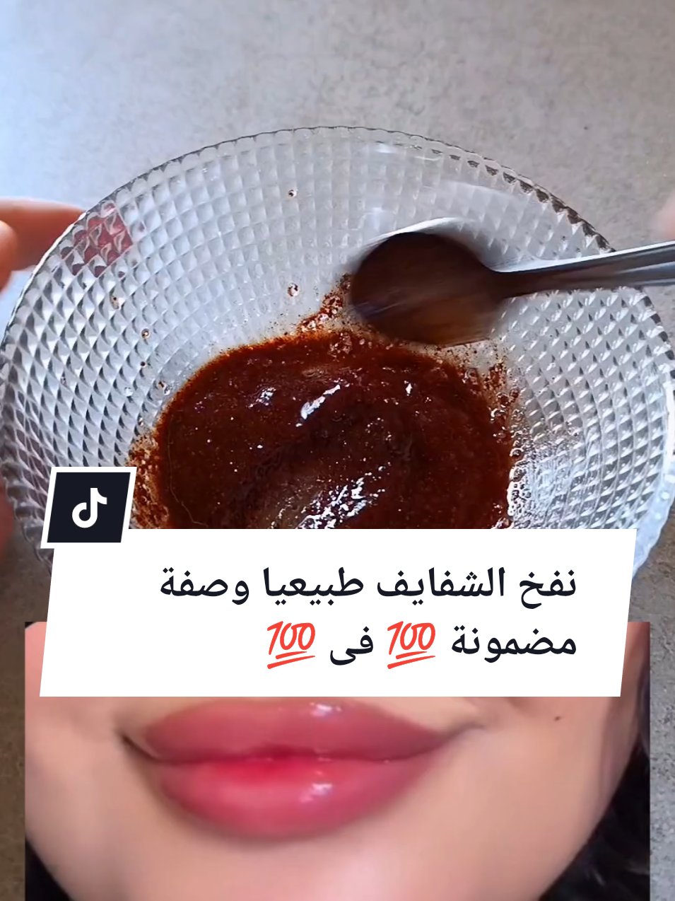 #نفخ الشفايف طبيعيا وصفة طبيعية-مضمونة💯#بطوكس #فيلر #طبيعي -شفايف-وصفات#طبيعية #foryoupage❤️❤️ #f #forypupage #f #الشعب_الصيني_ماله_حل😂😂 